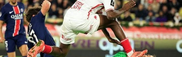 电竞比分-唐纳鲁马惨被鞋钉“刷脸” 专家：处理很好，不会破相